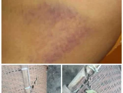 Dua Perempuan di Desa Tanjung Jere Jadi Korban Penganiayaan dan Ancaman, Menuntut Keadilan atas Tuduhan Tak Berdasar