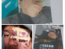 Dua Warga Desa Bisui Jadi Korban Penganiayaan dan Pengeroyokan oleh Oknum Warga Desa Lelewi